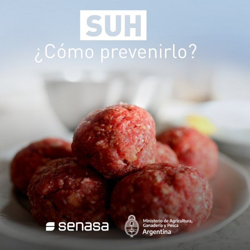 El Síndrome Urémico Hemolítico (SUH) es una enfermedad transmitida por los alimentos 