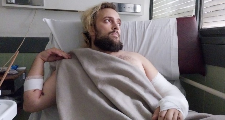 ”Me salvaron el casco y la mochila de Rappi, que tenía puestos”